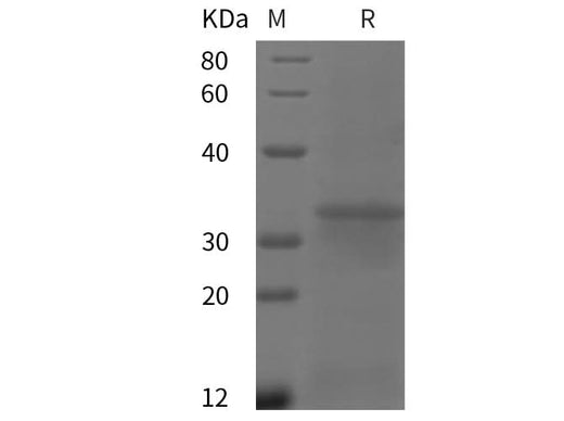 SDS-PAGE analysis of Human FCGR1A/CD64 proteins, 2 μg/lane of Recombinant Human FCGR1A/CD64 proteins was resolved with SDS-PAGE under reducing conditions, showing bands at 35 kDa.