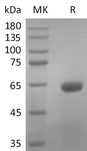 Recombinant SARS-CoV-2 S Protein RBD (C-mFc) V2 - ABMIUM