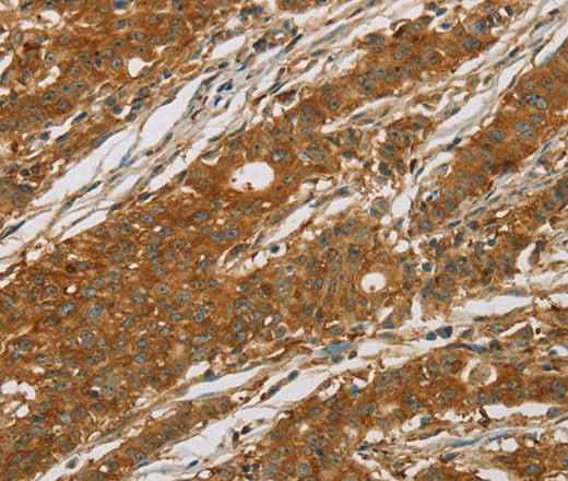 Anti-Human CYP27A1 Antibody
