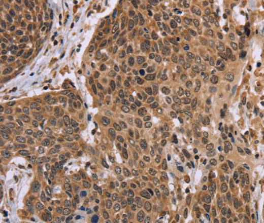 Anti-Human EDN2 Antibody - ABMIUM