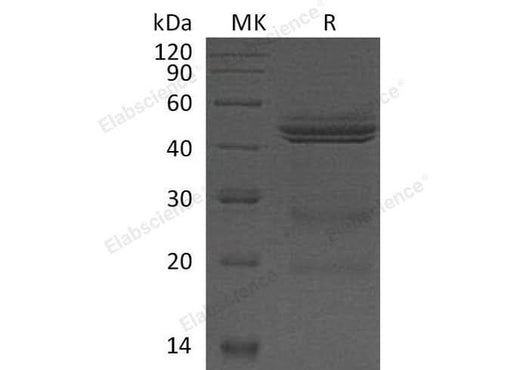 Recombinant Mouse Interleukin-12/IL-12 Protein - ABMIUM