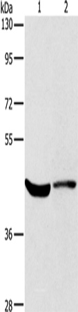 Anti-Human/Mouse KCNA7 Antibody - ABMIUM