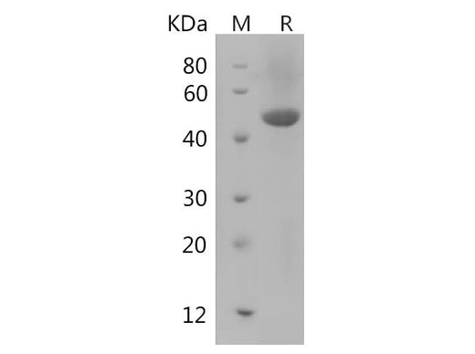 SDS-PAGE analysis of Rat Ager proteins, 2 μg/lane of Recombinant Rat Ager proteins was resolved with SDS-PAGE under reducing conditions, showing bands at 45 kDa.