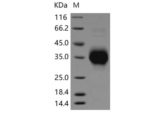 Recombinant Rat TNFR1/TNFRSF1A Protein (His Tag) - ABMIUM