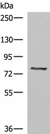 Western blot analysis of 293T cell lysate using TGFBI Polyclonal Antibody at dilution of 1:1050
