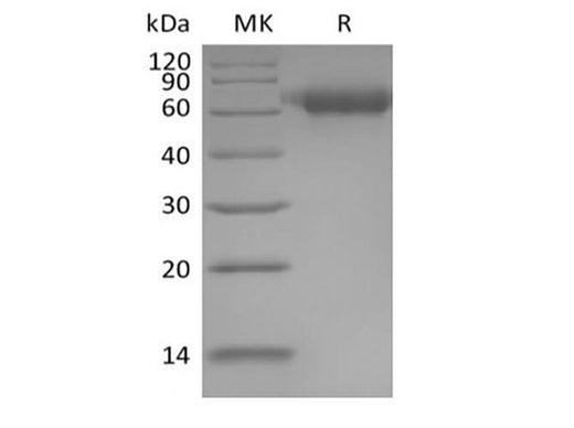 Recombinant Human IL-1 Receptor Accessory Protein/IL-1RAcP/IL-1R3 (C-6His) - ABMIUM
