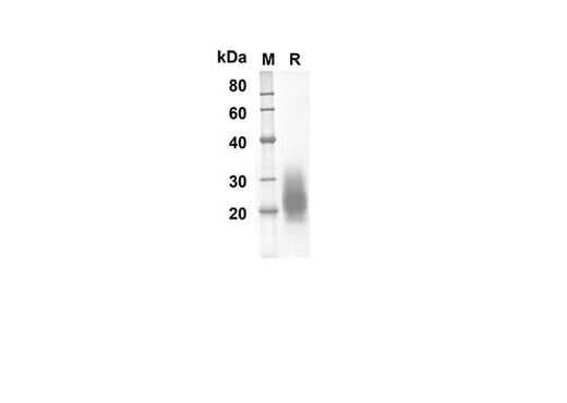 SDS-PAGE analysis of Human GM-CSF proteins, 2 μg/lane of Recombinant Human GM-CSF proteins was resolved with SDS-PAGE under reducing conditions, showing bands at 13.9 kDa.