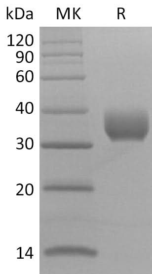 Recombinant SARS-CoV-2 Spike RBD (V483A)(His Tag) - ABMIUM