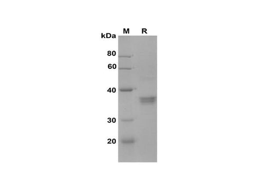 SDS-PAGE analysis of Mouse Acp5 proteins, 2 μg/lane of Recombinant Mouse Acp5 proteins was resolved with SDS-PAGE under reducing conditions, showing bands at 38 kDa.