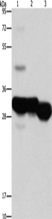 Anti-Human/Mouse KHK Antibody - ABMIUM