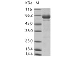 > 85 % as determined by reducing SDS-PAGE.