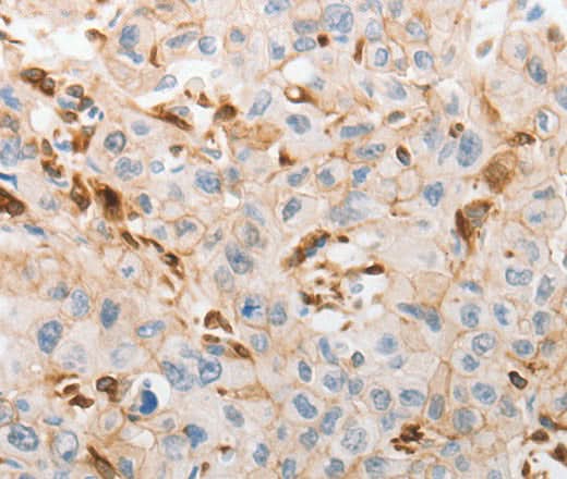 Anti-Human SLC15A2 Antibody - ABMIUM