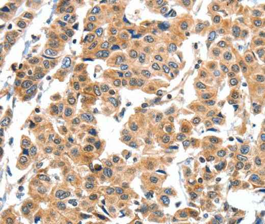 Anti-Human XBP1 Antibody