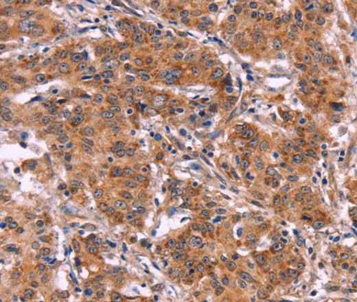 Anti-Human/Mouse/Rat MMP14 Antibody