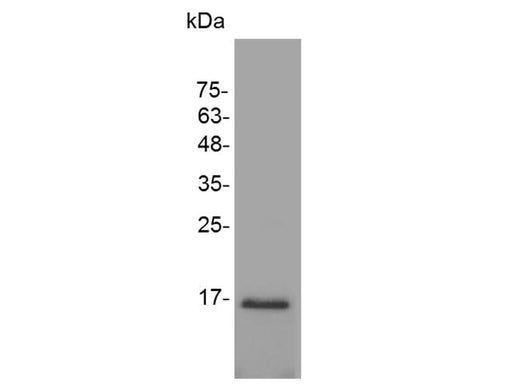 Recombinant Mouse TGF beta 1 protein(His Tag) - ABMIUM