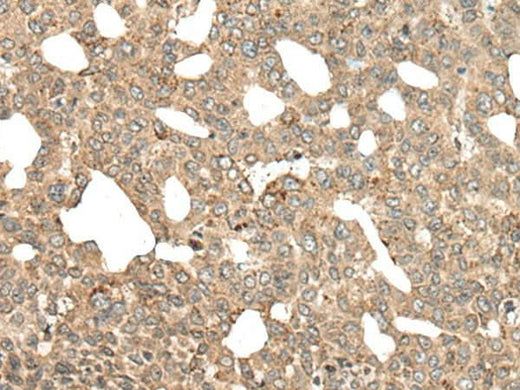 Anti-Human/Mouse/Rat APC Antibody - ABMIUM