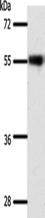 Anti-Human/Mouse/Rat SLC32A1 Antibody - ABMIUM