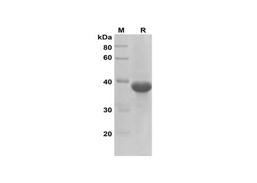 SDS-PAGE analysis of Rat IL-6 proteins, 2 μg/lane of Recombinant Rat IL-6 proteins was resolved with SDS-PAGE under reducing conditions, showing bands at 38 kDa.