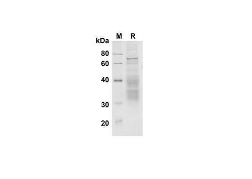 SDS-PAGE analysis of Mouse Clusterin proteins , 2 μg/lane of Recombinant Mouse Clusterin proteins was resolved with SDS-PAGE under reducing conditions , showing bands at 35-45 kDa.