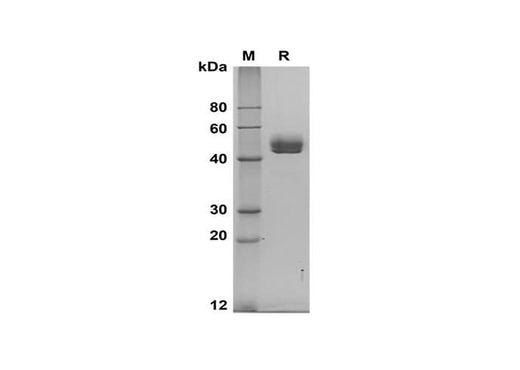 SDS-PAGE analysis of Rat Renin 1 proteins, 2 μg/lane of Recombinant Rat Renin 1 proteins was resolved with SDS-PAGE under reducing conditions, showing bands at 45-50 kDa.