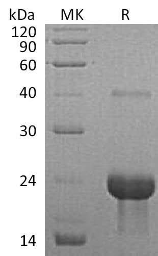 Recombinant Mouse TNFR1/TNFRSF1A Protein - ABMIUM