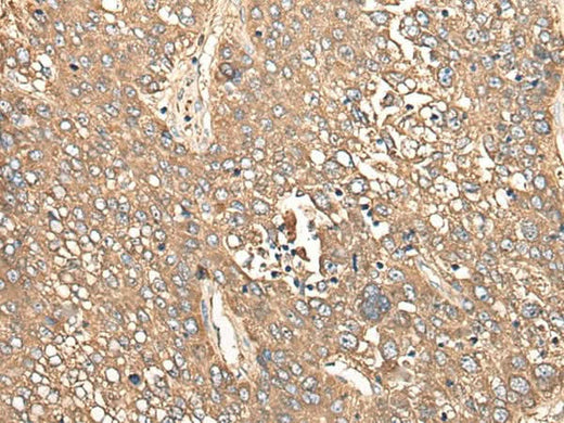 Anti-Human/Mouse/Rat CALB1 Antibody - ABMIUM