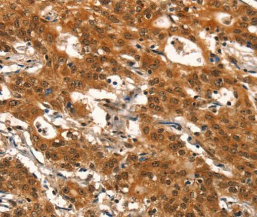 Anti-Human DEAF1 Antibody - ABMIUM