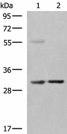 Western blot analysis of Human fetal liver tissue Jurkat cell lysates using KHK Polyclonal Antibody at dilution of 1:550