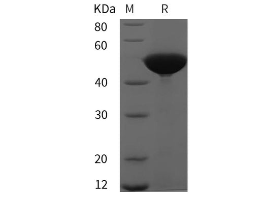 SDS-PAGE analysis of Human PGD proteins, 2 μg/lane of Recombinant Human PGD proteins was resolved with SDS-PAGE under reducing conditions, showing bands at 55 kDa.