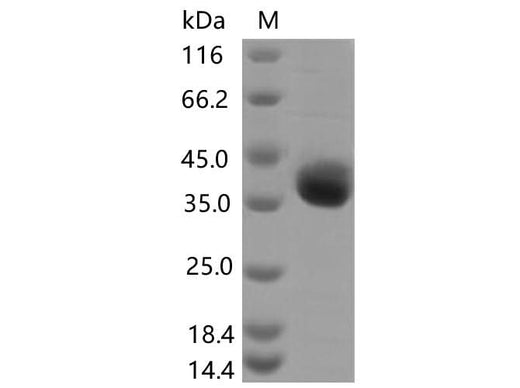 Recombinant SARS-CoV-2 Spike RBD(E406Q)(His Tag) - ABMIUM