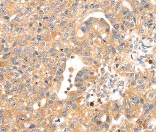 Anti-Human S100A12 Antibody