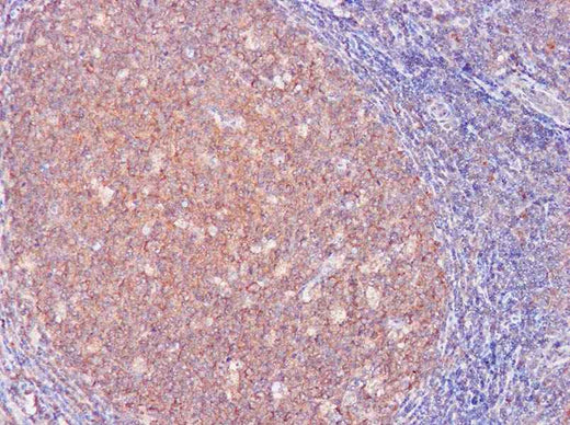 Anti-Human IL-3 Antibody - ABMIUM