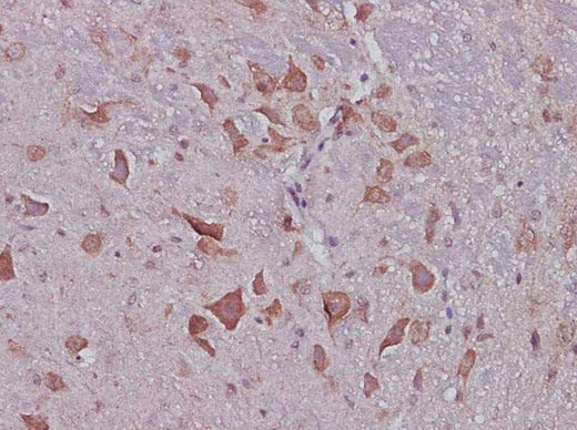Anti-Mouse CNTF Antibody - ABMIUM