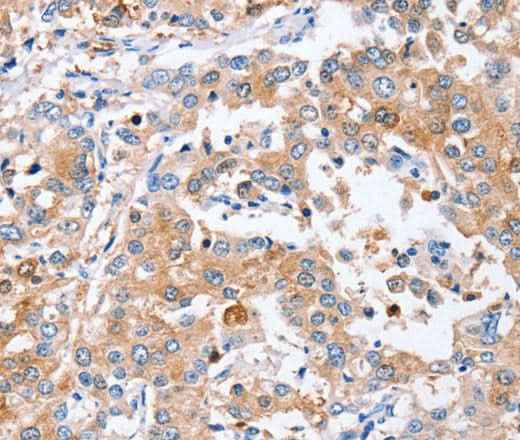 Anti-Human/Mouse PPOX Antibody