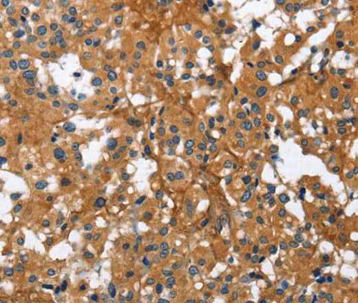 Anti-Human/Mouse/Rat BGN Antibody