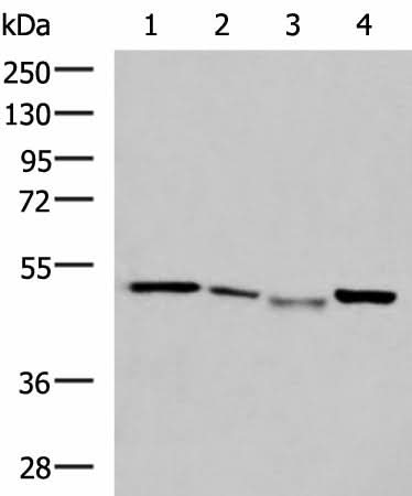 Western blot analysis of HepG2 cell Hela cell Mouse kidney tissue K562 cell lysates using NFS1 Polyclonal Antibody at dilution of 1:800