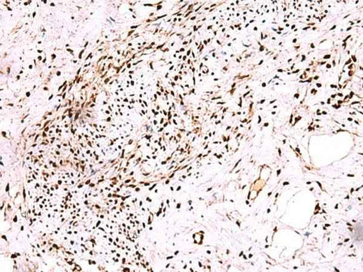 Anti-Human/Mouse CDKN1B Antibody