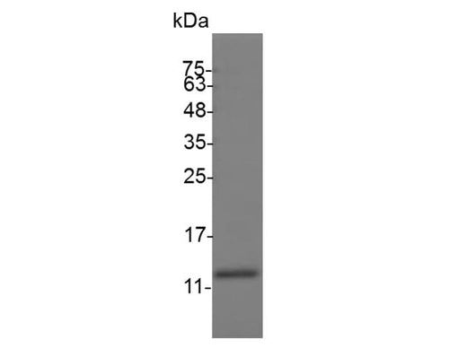 Recombinant Swine IL-4 protein(His Tag) - ABMIUM