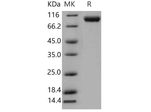Recombinant Mouse VCAM1 Protein (His Tag) - ABMIUM