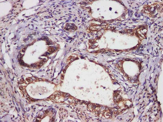 Anti-Human Bcl-2 Antibody - ABMIUM