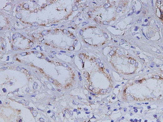 Anti-Human IGFBP7 Antibody