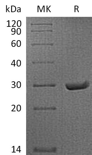 Recombinant Mouse APCS/SAP Protein (His Tag) - ABMIUM