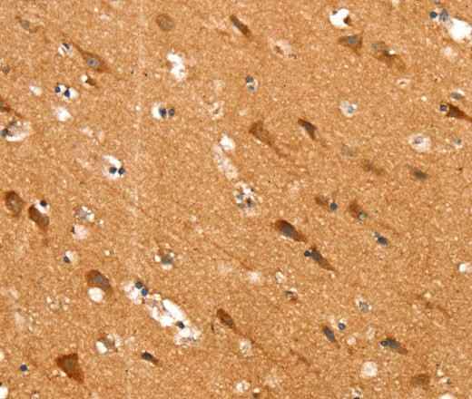 Anti-Human/Mouse SLC25A12 Antibody