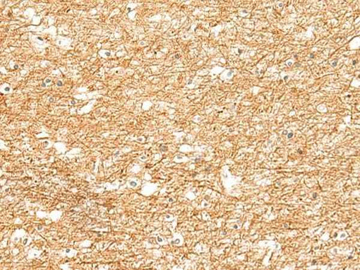 Immunohistochemistry of paraffin-embedded Human brain tissue using ZNF185 Polyclonal Antibody at dilution of 1:25(×200)