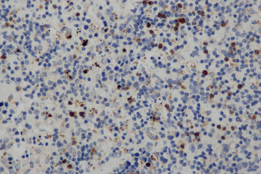 Anti-Human CD68 Antibody - ABMIUM