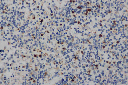 Anti-Human CD68 Antibody