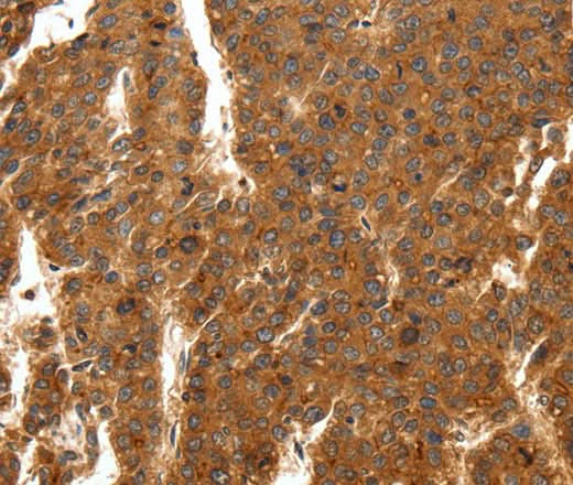 Anti-Human/Mouse/Rat SCN11A Antibody - ABMIUM
