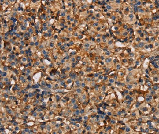 Anti-Human/Mouse PLXNA1 Antibody - ABMIUM