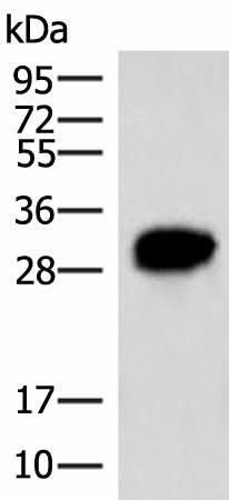 Western blot analysis of HepG2 cell lysate using HCCS Polyclonal Antibody at dilution of 1:4000