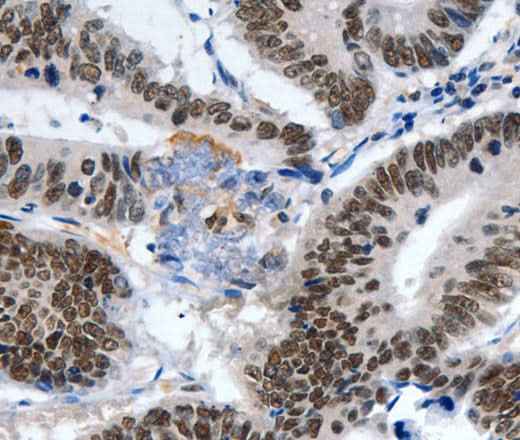 Anti-Human/Mouse LRP5 Antibody